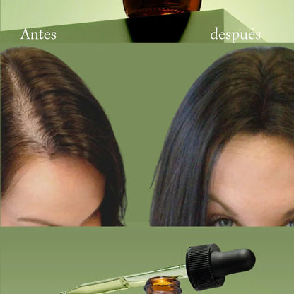 MIELLE® Serum – Doble Potencia para el Crecimiento Capilar - FraDa Store